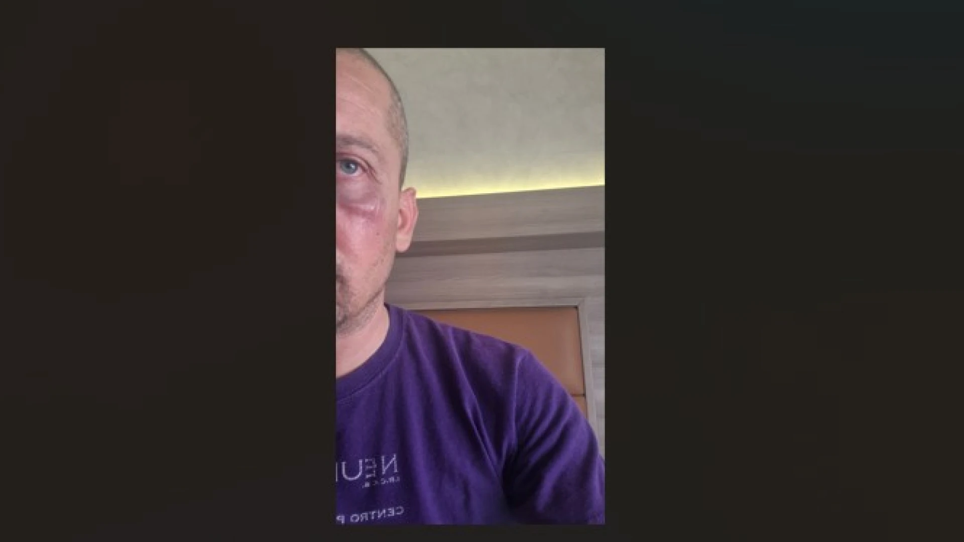 Solidarietà a Luca Petrangelo dopo l’aggressione subito dalla Lega Molise. La nota del commissario regionale vicario Ivan Forte.